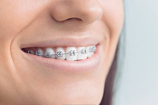 Best Full Mouth Reconstruction  in Green Valley, MD
